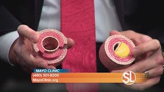 Mayo Clinic discusses cholesterol and the importance of your numbers