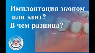 картинка: Имплантация эконом или элит? В чем разница?