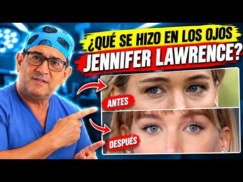 La cirugía que cambió la mirada de JENNIFER LAWRENCE