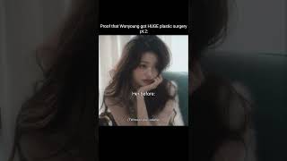 So Much Plastic Surgerypt.2