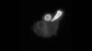Drinking Dictyostelium Amoeba Imaged On A Snouty Sols Microscope