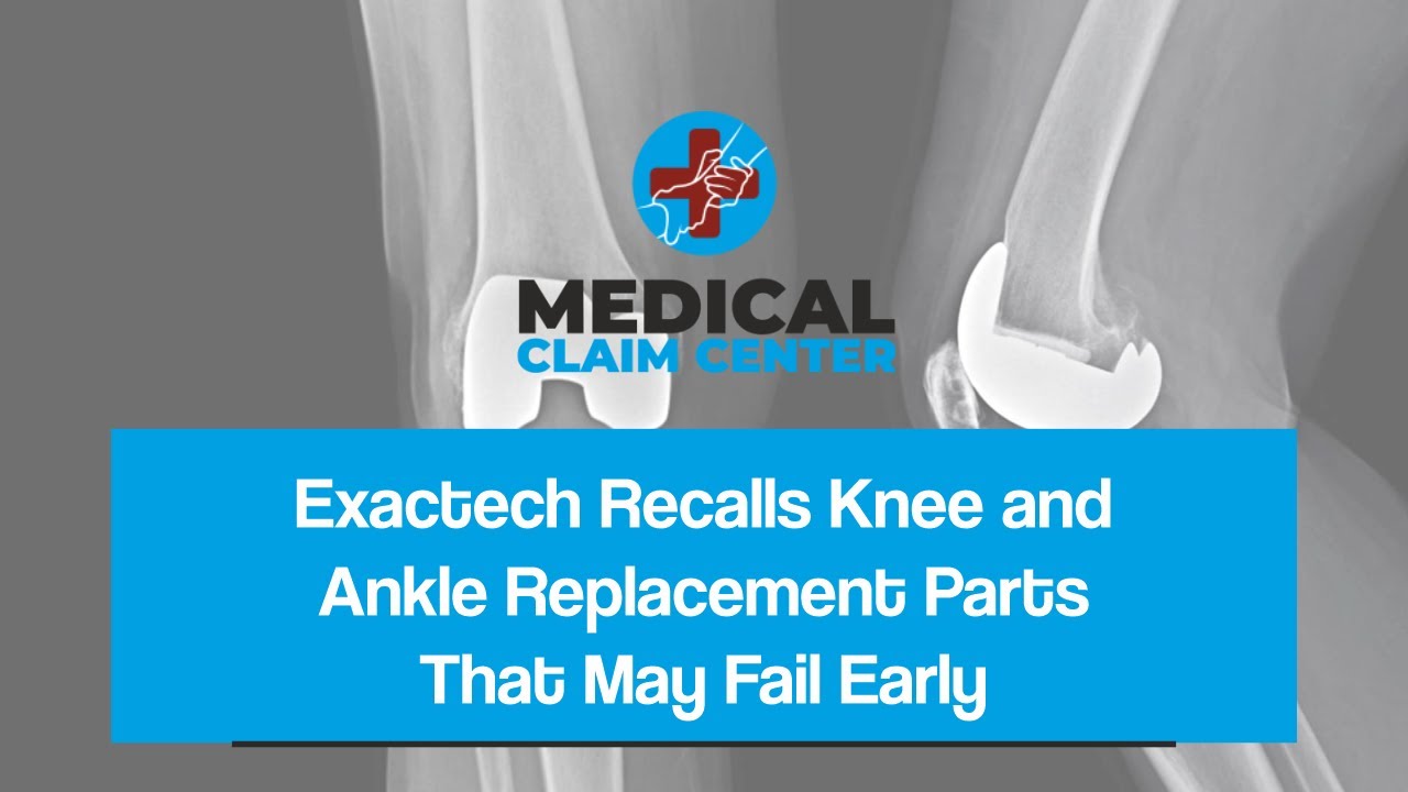 Exactech Recalls Knee and Ankle Replacement Parts That May Fail Early