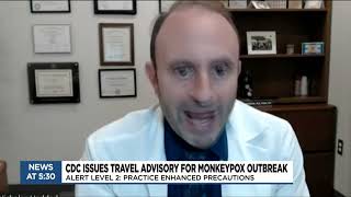 CDC issues new travel guidelines as monkeypox continues to spread