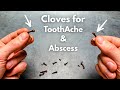 Do Cloves / Clove Oil ACTUALLY Work for ToothAche &amp; Dental Abscess?