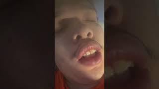 Update on lp this year