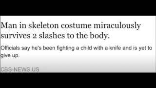 man in skeleton costume survives 2 slashes to the body