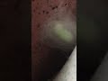 冬にモンシロチョウのサナギ前が