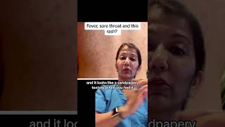 Fever , sore throat rash? Scarlet fever #doctor
