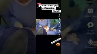 عملية مفصل الحوض الصناعي