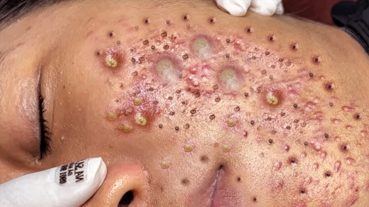 𝑺𝒐𝒐𝒕𝒉𝒊𝒏𝒈 𝑭𝒂𝒄𝒊𝒂𝒍 𝑻𝒓𝒆𝒂𝒕𝒎𝒆𝒏𝒕 𝒇𝒐𝒓 𝑺𝒕𝒓𝒆𝒔𝒔 𝑹𝒆𝒍𝒊𝒆𝒇 | 𝑫𝒆𝒆𝒑 𝑪𝒍𝒆𝒂𝒏𝒊𝒏𝒈 & 𝑪𝒂𝒍𝒎𝒊𝒏𝒈 𝑴𝒂𝒔𝒔𝒂𝒈𝒆 𝒂𝒕 𝑳𝒖𝒙𝒖𝒓𝒚 𝑺𝒑𝒂 