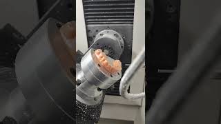 Dental Aligner Trimming