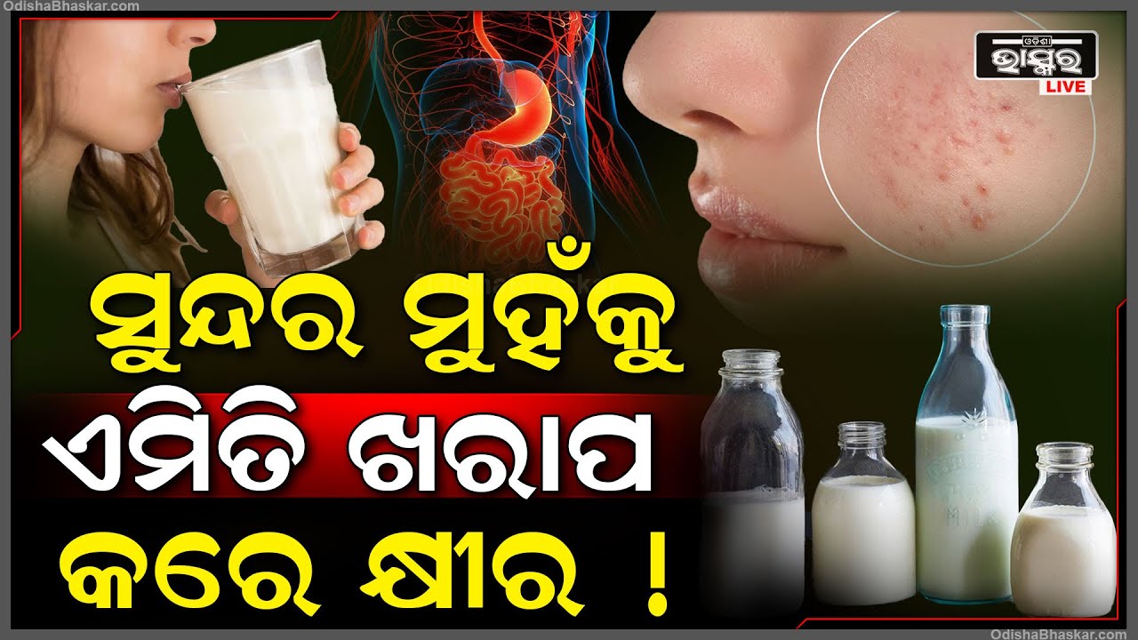 ସୁନ୍ଦର ମୁହଁକୁ ଏମିତିି ଖରାପ କରୁଛି କ୍ଷୀର ! ମୁହଁରେ ବ୍ରଣ ସହ ଆକ୍‌ନେ ହେବା ପଛରେ ରହିଛି ଏହି କାରଣ ।