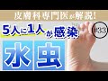 水虫の薬を買いに行く前に見る動画