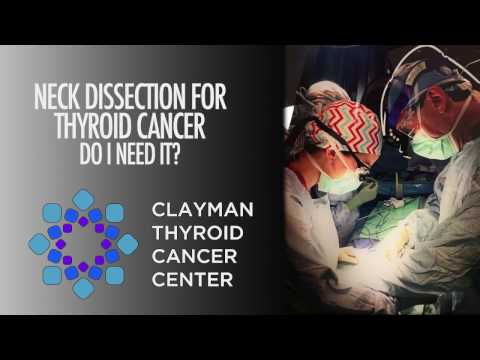 Neck Dissection for Thyroid Cancer Do I Need It