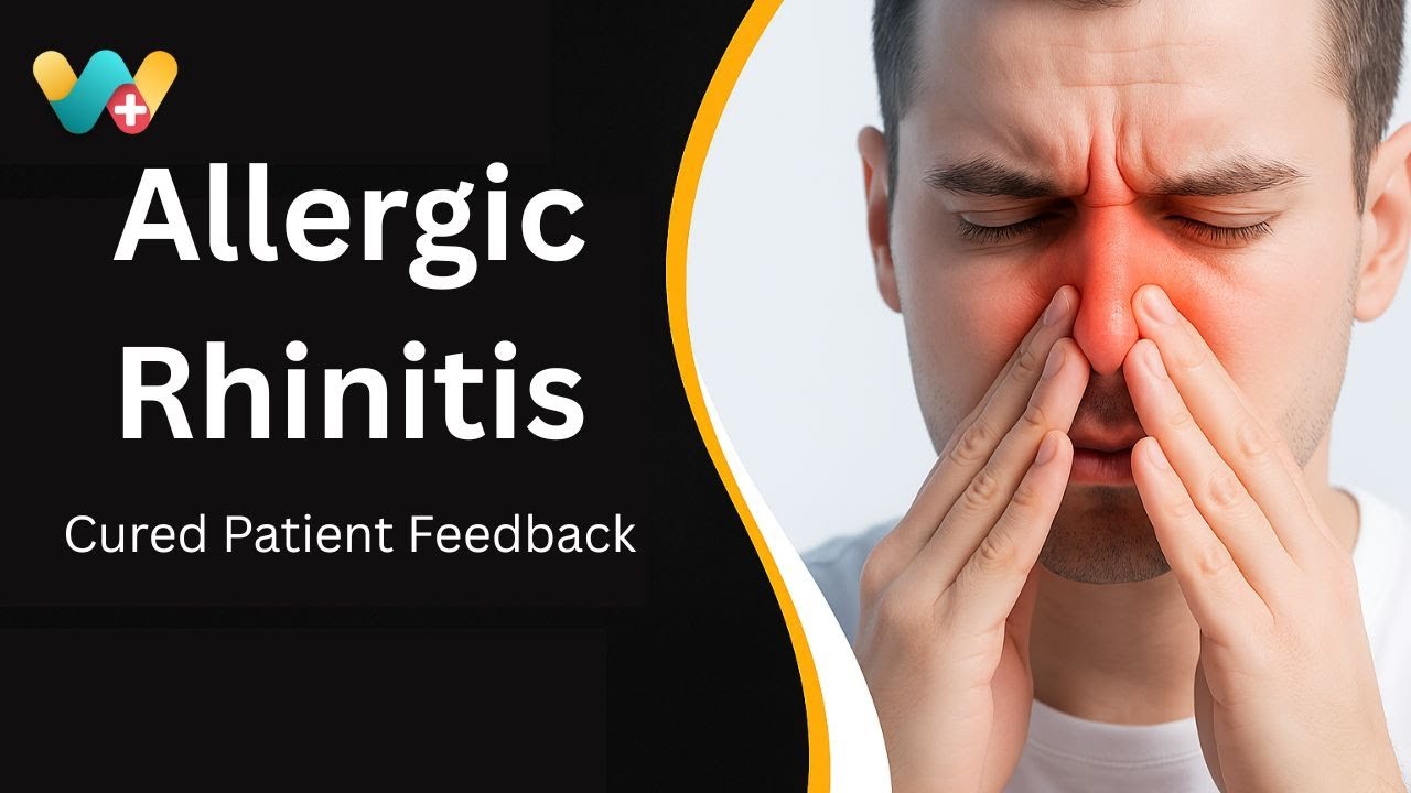 Allergic rhinitiska homeopathy Ilaj - Patel Vipulkumar ji ki Success Story |  360173