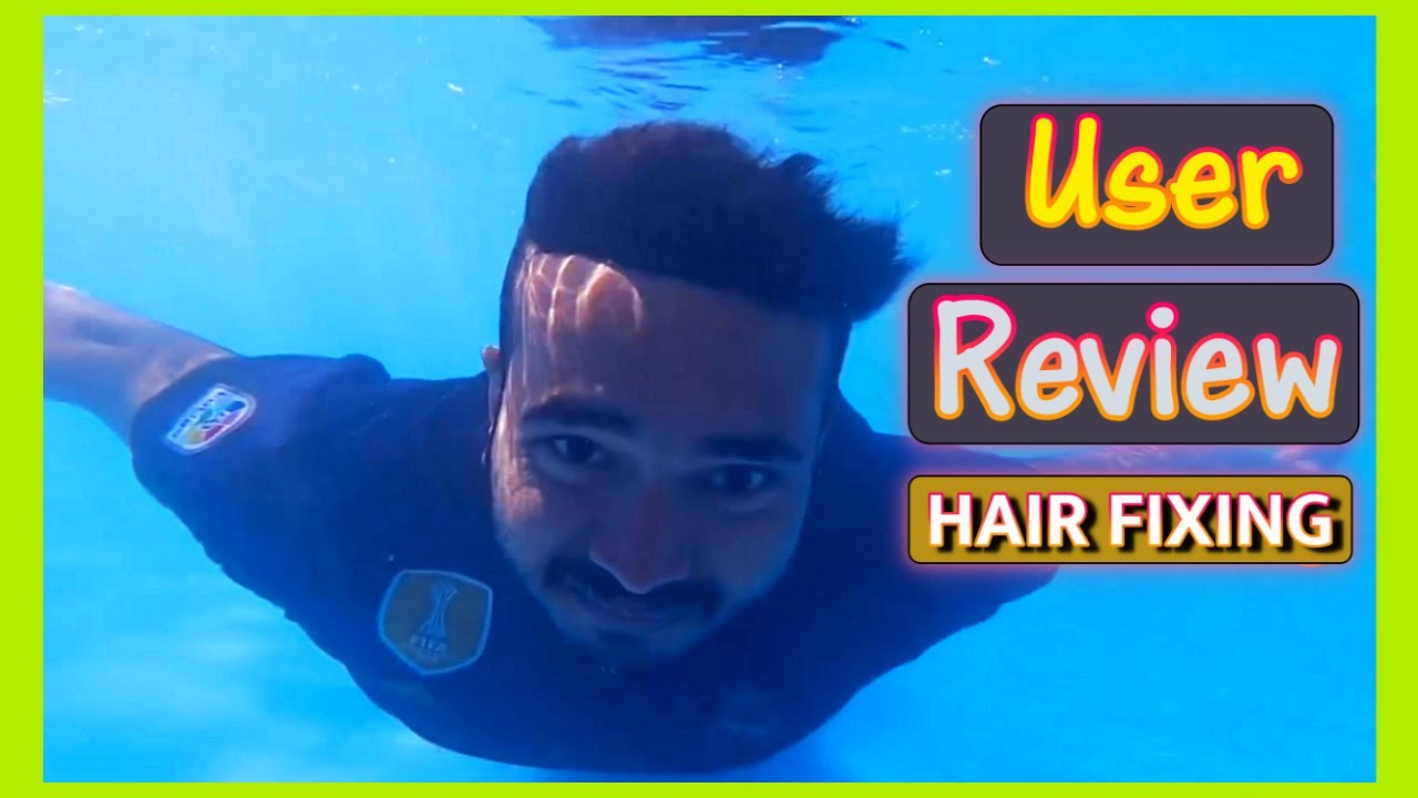 User Review Hair Replacement System Rampura Dhaka HAIR LINK