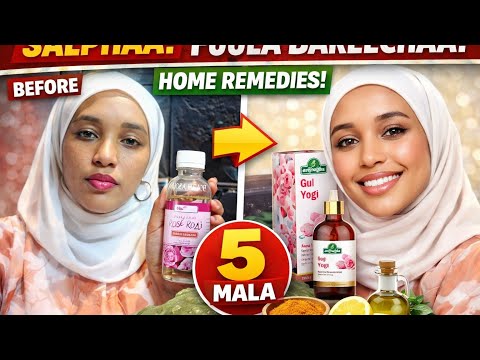 Maaltota Mana Keessaa Fuula Bareechan Dhugaa Qofa 