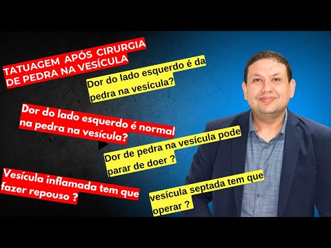 PEDRA NA VESÍCULA- tatuagem, dor do lado esquerdo é normal? Pode parar de doer?