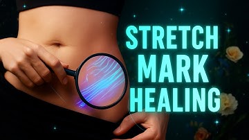 🧵 Stretch Mark Reduction | Deep Tissue Remodeling + Elastin Renewal