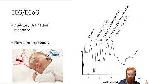Electrophysiology 3 - EEG and ECoG