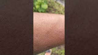 Download Lagu #deaf #Tsetse fly  care MP3