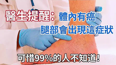医生提醒：人体内有癌，腿部先知！腿部出现这症状，或是提醒你肿瘤来袭！千万别忽视，早知治疗还不晚！分享出去，救人无数！ - 天天要闻