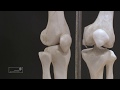 Knie- und Hüftbeschwerden – Wann sollte man über eine Operation nachdenken?