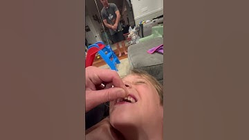 Best way to pull out a tooth! #toothfairy #loosetooth #toothless #insanemullane #pulloutatooth #fish
