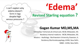 The Modified Starling Equation - made easy.