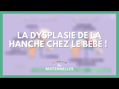 La dysplasie de la hanche chez le bébé !  - La Maison des maternelles #LMDM