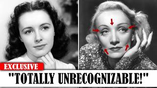 20 Surgeries Vintage Stars Did In SECRET That Transformed Them Forever
