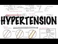 Hypertension - Overview (causes, pathophysiology, investigations, treatment