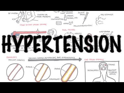 Video: Arterial Hypertension - Treatment, Prevention, Degree, Stage