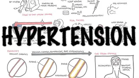 Hypertension - Overview (causes, pathophysiology, investigations, treatment