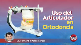 Porque Usar Articulador en Ortodoncia