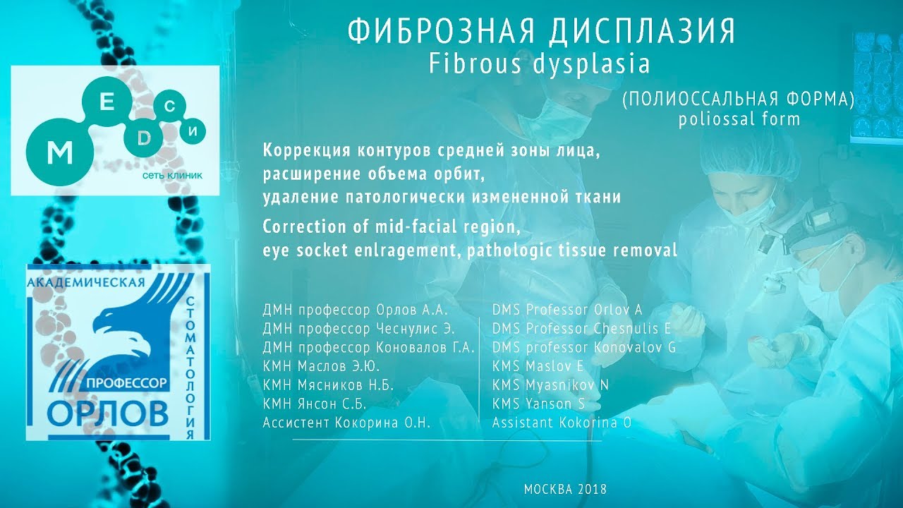 Фиброзная дисплазия. Часть 1 (Полиоссальная форма) Профессор Орлов А.А.