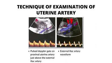 Role of Color Doppler in detection and management of IUGR 