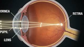 How do we see an object? Science is everywhere. Keep asking why. #vision #human_eye #optic #nerve How do we see an object? Science is everywhere. Keep asking why. #vision #human_eye #optic #nerve