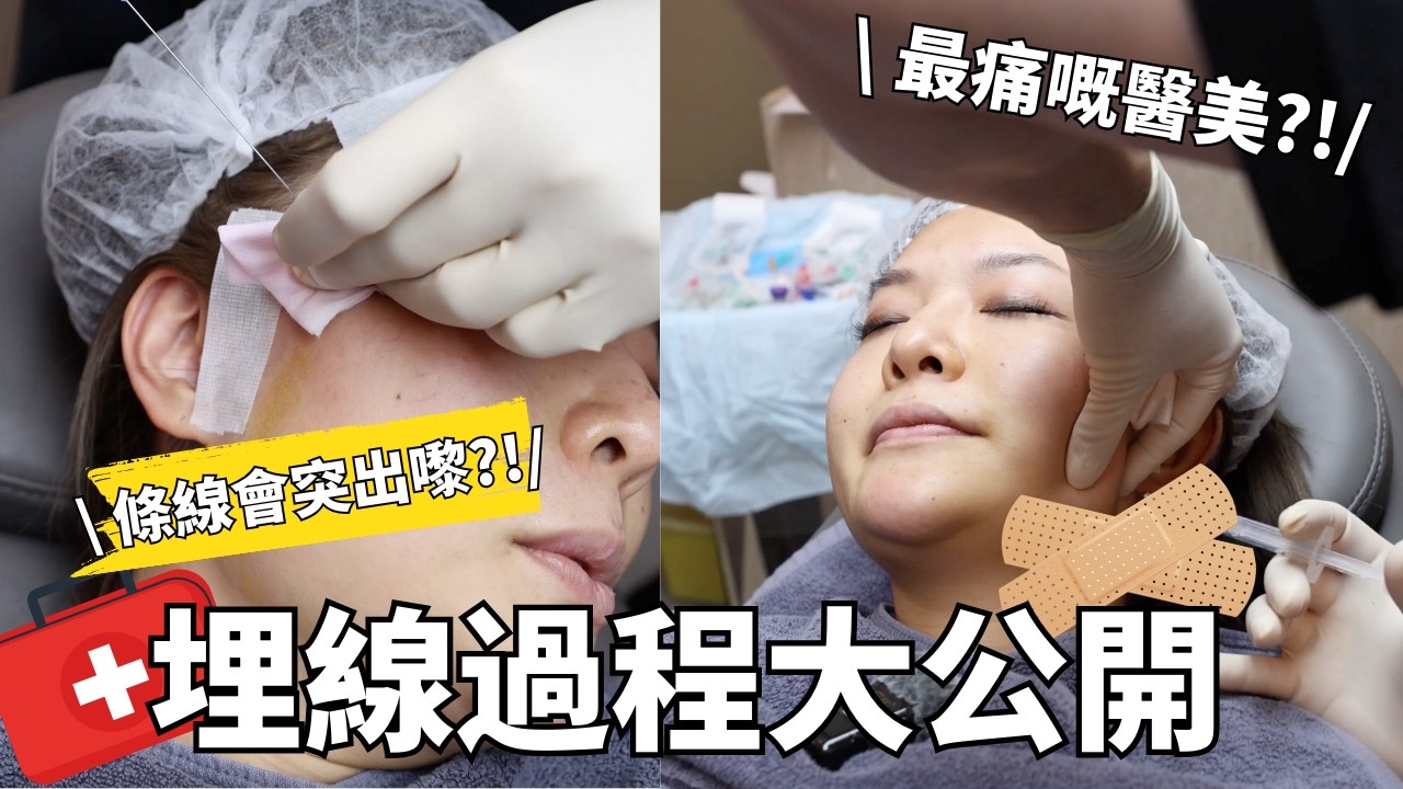 🧐「最痛醫美」埋線有幾痛？第一身過程大公開‼️| 成效顯著值得做？醫美療程真實分享 | Yoyo Yip MakeUp