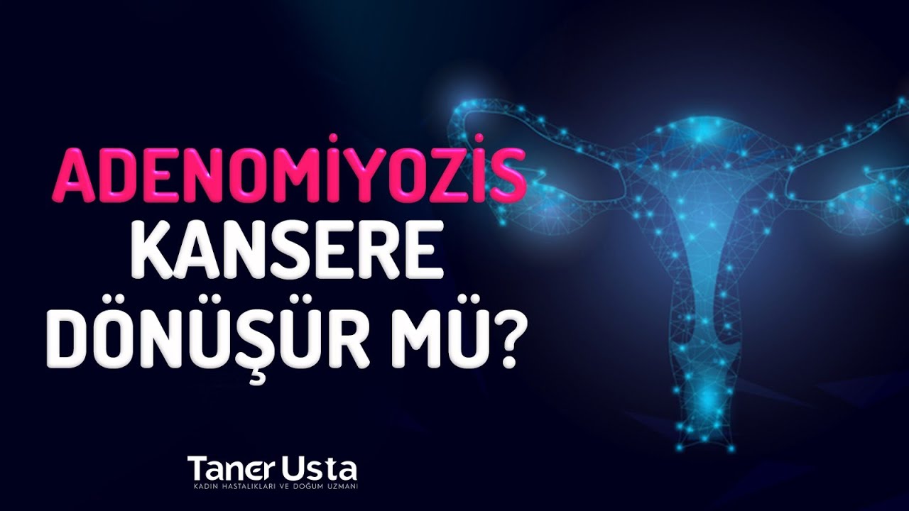 Adenomiyozis Kansere Dönüşür Mü? - Prof. Dr. Taner Usta