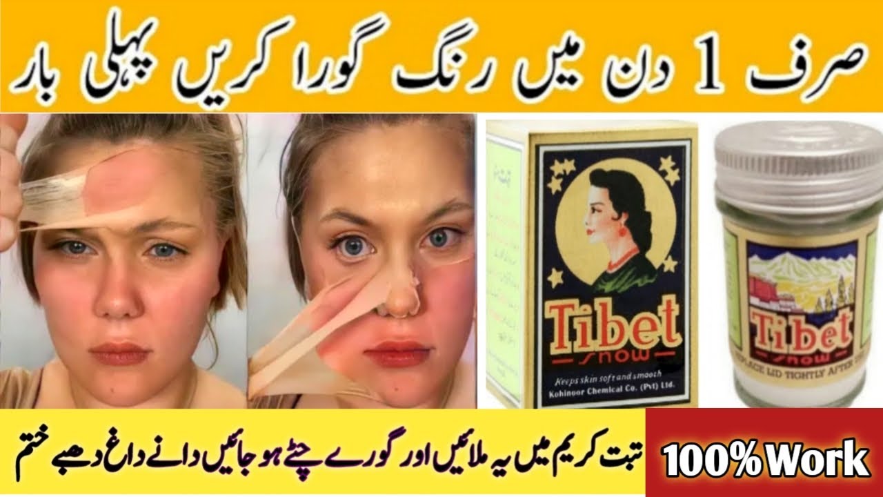 Tibet Cream For Skin Whitening | Tibet Cream Se Rang Gora Karne Ka Tarika | Instant Fairness