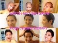 Hairgrowth Post-Chemotherapy | Young women with Breast Cancer