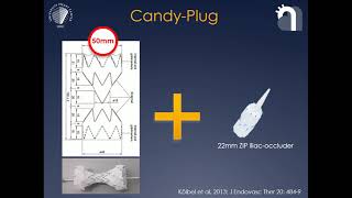 11.00-11.10: Adjunctive Techniques for Treating Chronic Dissection, Tilo Koebel, MD