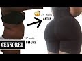 HOW I WENT FROM A SIZE 38" TO 25" WAIST AFTER LIPO & BRAZILIAN BUTT LIFT | WEIGHT LOSS JOURNEY