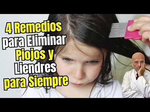 ⚠️🪳4 REMEDIOS CASEROS PARA ELIMINAR PIOJOS Y LIENDRES DEFINITIVAMENTE⚠️🪳