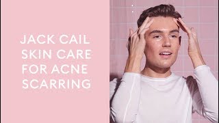 #myMECCAskin with Jack Cail