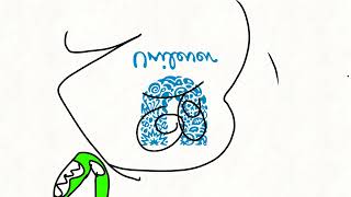 Countryballs Brazil Vs Unilever Vs Fight Cloud Running