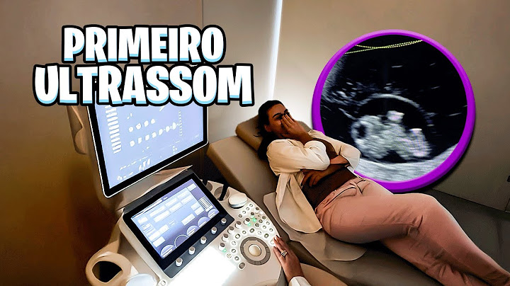 WE HAD OUR BABY'S FIRST ULTRASOUND!!