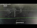 Как настроить режим, осциллограф Постоловского