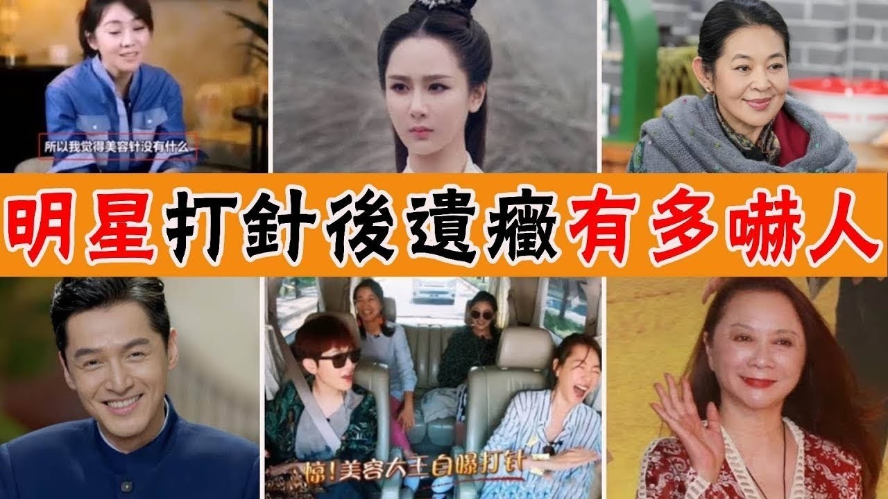 揭秘娛樂圈明星整容內幕！胡歌縫了100多針，金晨修臉上百次，趙麗穎臉僵，鞠婧禕鼻子怪，醫美究竟毀了多少美女？倪萍,楊紫,閻妮,大S,李小璐,婁藝瀟,張抿,張萌,程莉莎,孫菲菲,蕭薔,蔡明